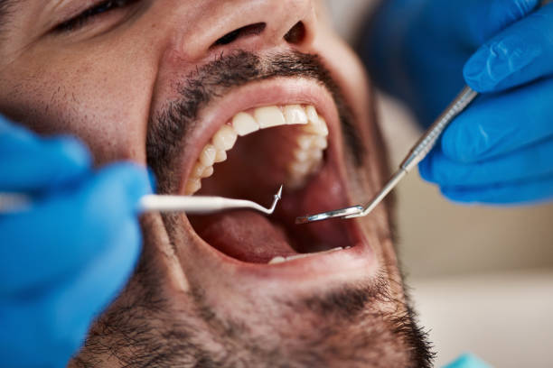 Best Dental Inlays and Onlays  in Fort Lewis, WA